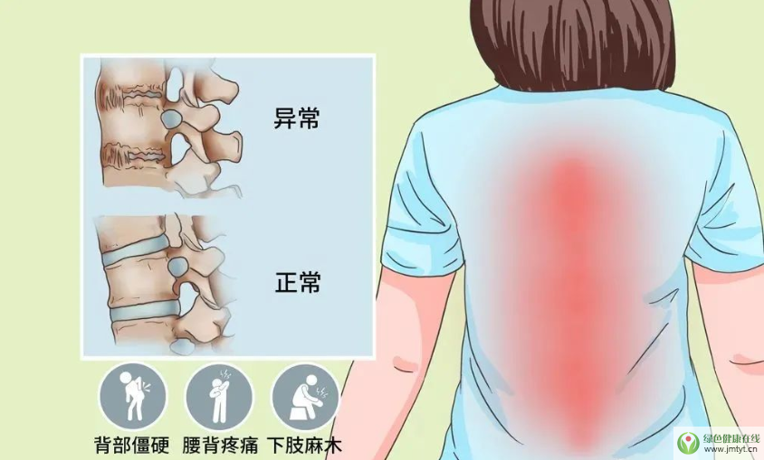 干细胞与强直性脊柱炎,间充质干细胞对脊柱强直的干预 干细胞与强直性脊柱炎,间充质干细胞对脊柱强直的干预